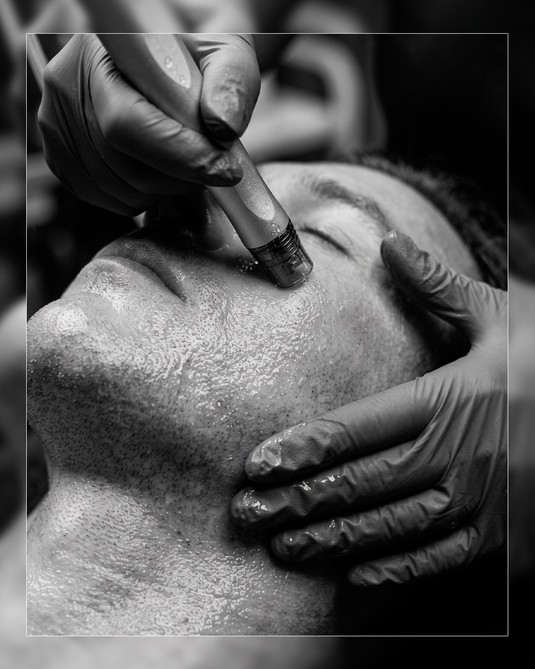 A Hydrafacial treatment head applied to a client's face at HK Salon For Men