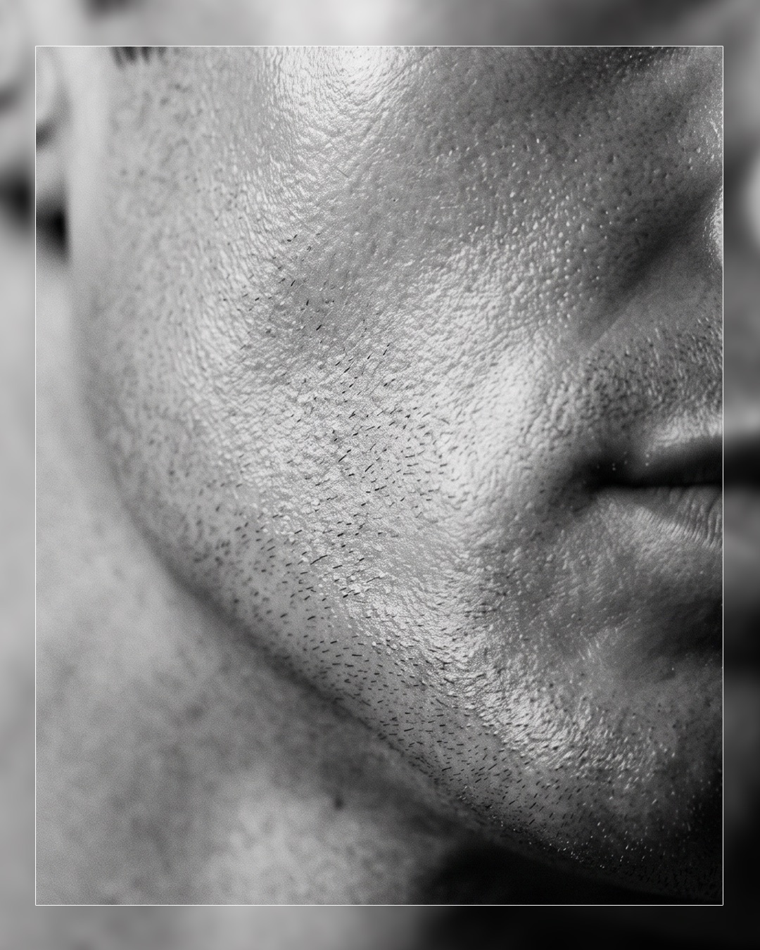 Close-up of a client's jawline after the Deep Clean Hydra Therapy